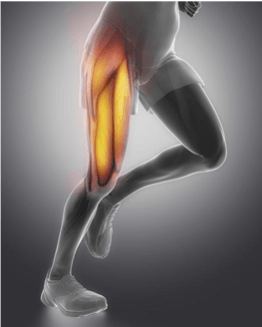 quad-strain